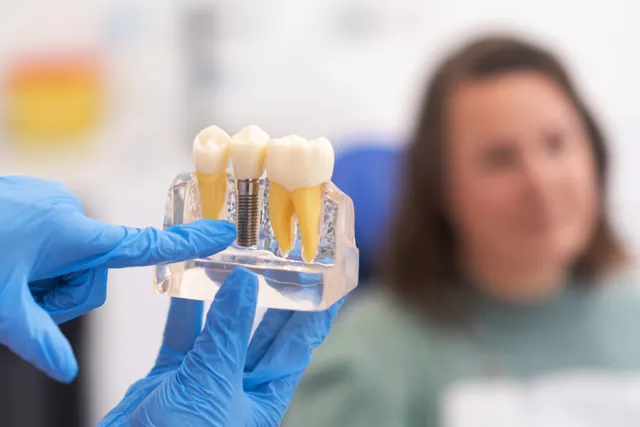 Natural-looking dental crown result on a restored smile