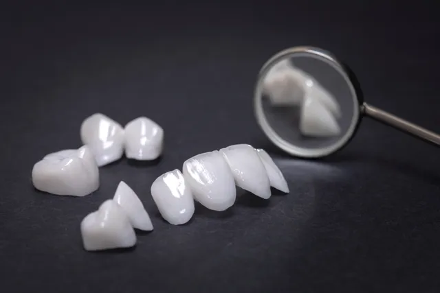 Confident smile showing the finished result of porcelain veneer treatment