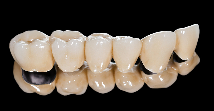 Restore Your Smile with Dental Bridges in Garland, TX