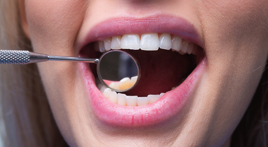 Why Dental Implants Are A Game-Changer In Restorative Dentistry?